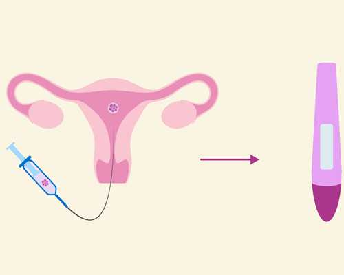 台湾试管婴儿哪家好~做代孕哪家医院好