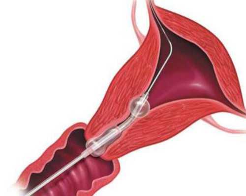 怎样预约香港验血机构_香港验血测男女报告,让亲历者用事实来讲述真相