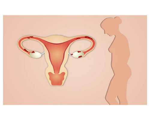 香港医生真的帮大陆孕妇验血吗_香港验血报告会有假吗准不准,哪家诊所准确率