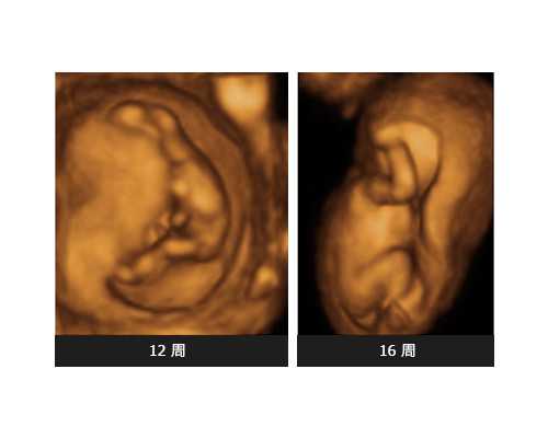 南昌哪里有去香港验血的中介_生化妊娠影响香港验血,查男女那些你所不知道的