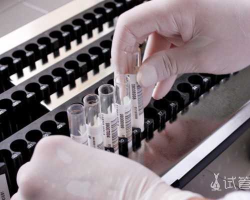 中介寄血去香港正规验血机构_澳门验血能测男女吗_验血详细流程,看完你还做吗