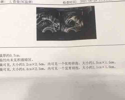 怎么直接去香港验血多少钱_传统文化手抄报中国传统文化手抄报怎么做？