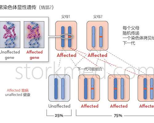 想去泰国做试管?怎么去泰国做试管婴儿?