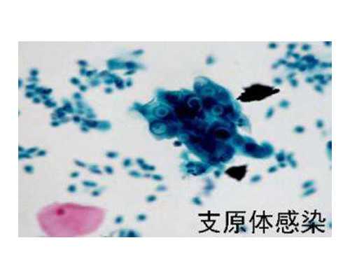 香港验血邮寄过去靠谱吗_时代香港验血报告单真假图_有Y男孩会翻盘吗!