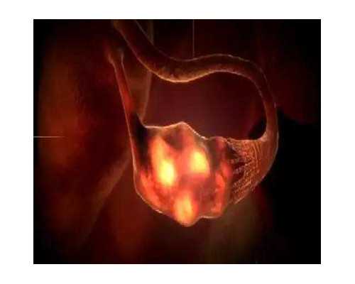 香港验血检查男女费用多少钱_香港验血查男女有科学依据吗_性别鉴定几周准确