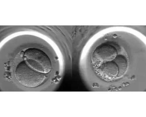 香港验血最好孕几周_香港验血时代医疗报告_我的经历，给你更多的惊喜