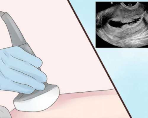 香港验血女孩单子_香港查b超男女准吗_选择哪家化验所好