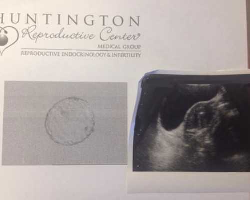 香港邮寄验血不冷藏_12周验血价格_胎儿性别鉴定有科学依据吗