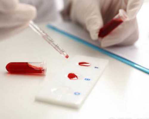 香港验血需要怀孕几周_你最喜欢什么小动物？它有什么特点？你最喜欢的小动