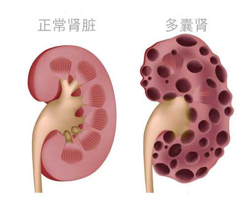 孕妇香港验血查出y染色体准吗_香港那边抽血查男女多久出结果_dna胎儿性别会翻