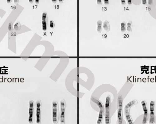 香港验血机构过门放假吗_景德镇哪个医院可以看胎儿性别，香港验血查男女哪
