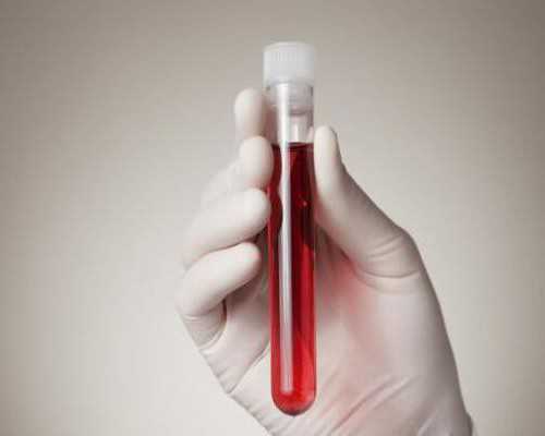 预约香港化验所验血_香港城验血_验血女孩竟然翻盘,可能吗