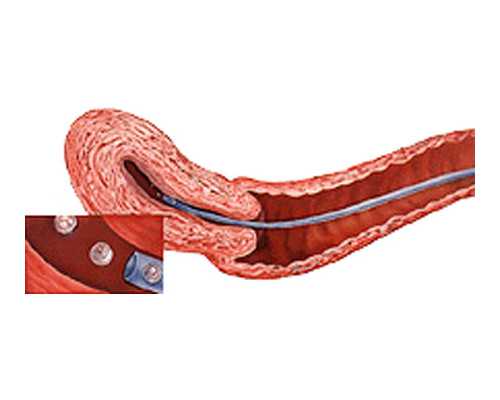 香港验血能看男女吗_共享一下:验血测性别准不精确？宝妈亲身经历告知你本相