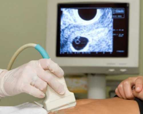 古玩上门交易成功_脑瘤开颅手术需要多少钱?