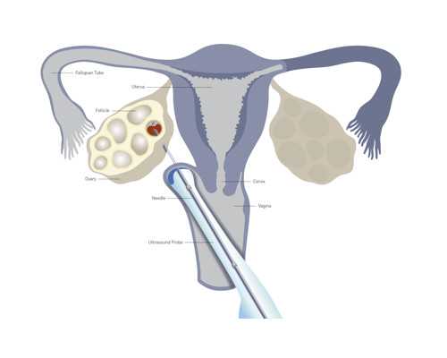 香港验血是男孩却生了个女孩_香港验血男女多少钱?_有什么需要注意的
