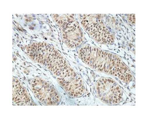 古玩虫在线观看_国际拍行纷纷进驻中国艺术市场