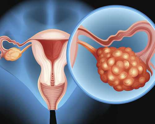 盛世古玩商_鸟与盆景