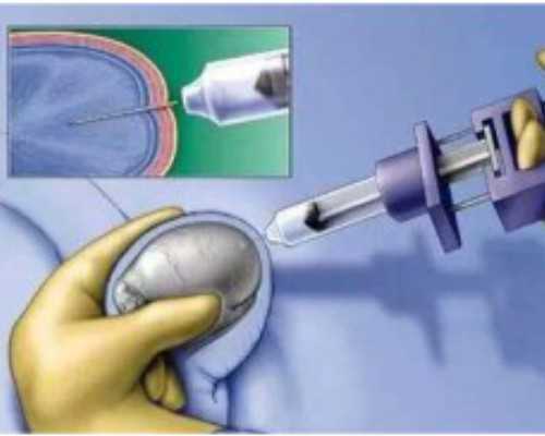 香港 孕检 验血_香港验血男孩单子,抽血鉴定性别要多少费用