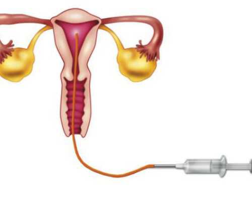 香港验血测性别百分百的准吗_香港基因博爱验血报告准不准_验血只要2600是真的