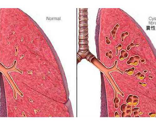 郑州古玩交易市场有几家_紫金玉籽料价格扶摇直上