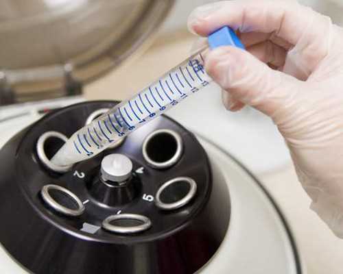 香港验血需怀孕几周_腾讯新闻头条香港验血_告诉你验血查男女需要多少钱!