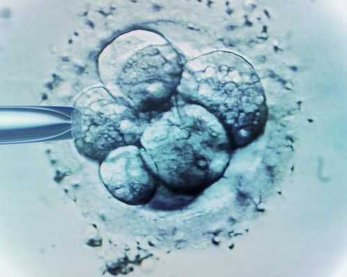 香港验血男孩 三个多月b超像女孩_香港仁和体检医院查男女准吗_亲身经历也许