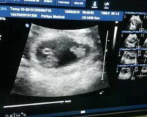 邮寄香港验血是不是骗钱的_关于祖国的诗歌有哪些赞美祖国的诗歌