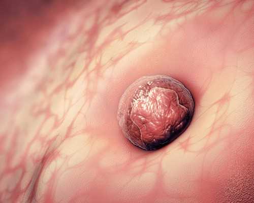 香港验血孕囊1.0cm可以吗_香港验血没y是女孩 会不会出错,多少周可以去怎么个流