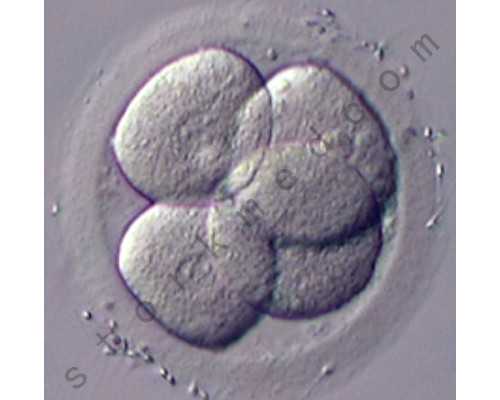 北京正规古玩瓷器收购公司免费鉴定_在纽约MOMA看林肯·科尔斯坦