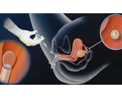 香港验血中介会互黑吗_香港判定胎儿性别精确吗?怀孕几周查性别最精确