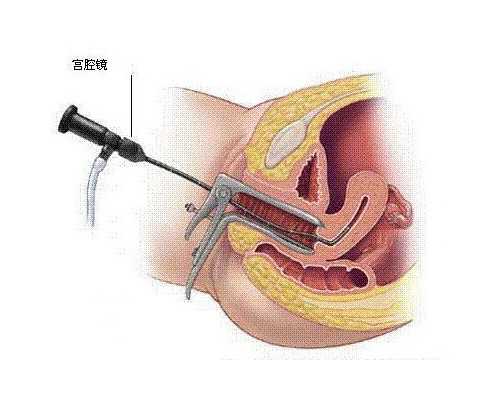 河南郑州古玩鉴定骗局_潮州小吃之笋饺