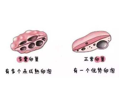 香港爱婴国际公司验血准吗_有没有两次香港验血结果不一样的_邮寄验血查男女