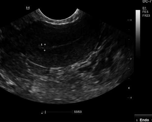 怀孕初期去香港验血测性别准吗_以《大爱之歌》为题的作文500字《我最爱的一