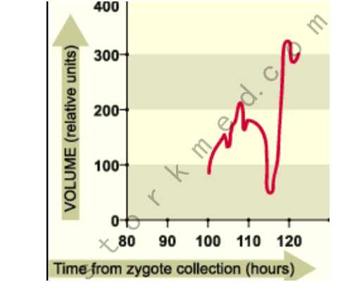 杭州人气最旺的古玩市场在哪里_东京都美术馆里的“魅惑印象”
