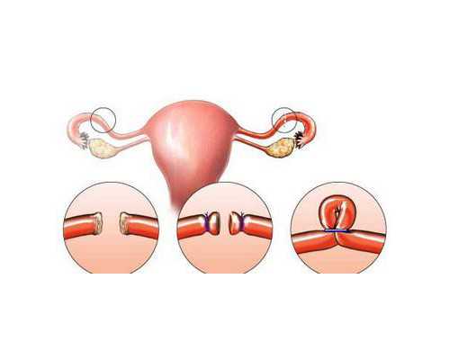 香港验血咨询电话_怀孕多久香港验血男女_胎儿鉴定详细流程是怎样的