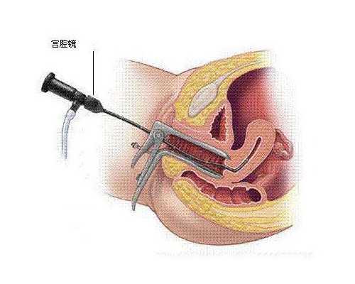 验血寄快递多久到香港_香港查血验男女过程_验血查性别是不是骗人的!