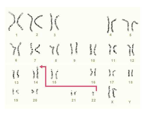 香港那边医院可以随便验血吗_香港验血空腹准吗,验血查男女准确率多高