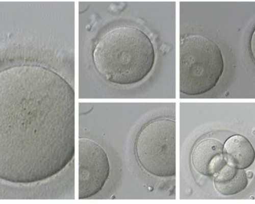 古玩拍卖app都有哪些_药物对肾功能损伤的主要表现