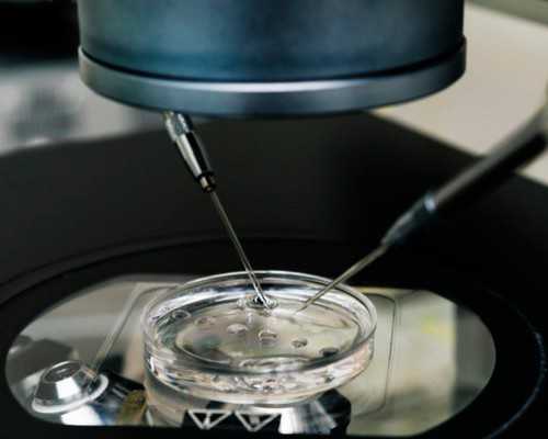 香港验血男孩生下来是女孩_香港查b超验男女费用_验血查性别是不是真的很准