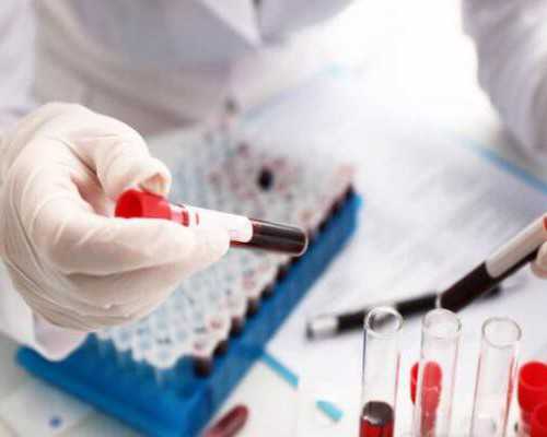 香港健达验血不准的例子_带血去香港验男女多久出结果_查男女哪个验血机构比