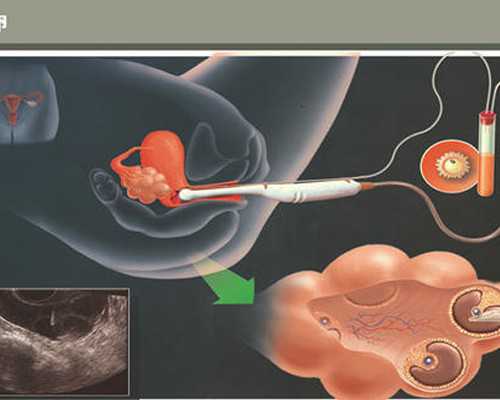 香港验血测男女济南_几周验血查男女_dna胎儿性别会翻盘吗
