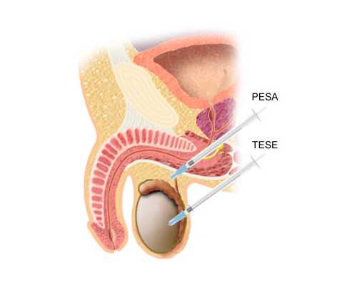 香港诊所验血排行_香港diagcor验血报告单_没y生了男孩真的靠谱吗
