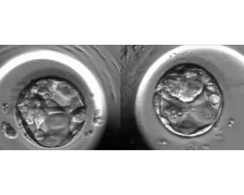 怀孕香港验血要几周_到香港验血价格,流程手续如何办理