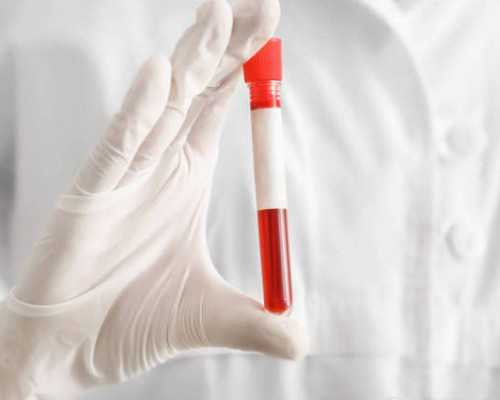 古玩微信上拍卖平台有哪些_五种需限制食用的食品