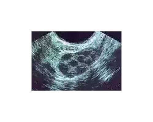 dna和香港验血价格_在香港刚怀孕查男女_实例分享看完你还做吗!