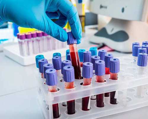 香港验血6着验的准吗_怀孕初期香港验血费用多少钱_几周检测最准,需要准备什