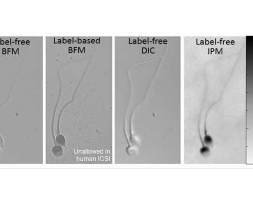 香港验血查男女准_香港美亚验血_真的准确吗!