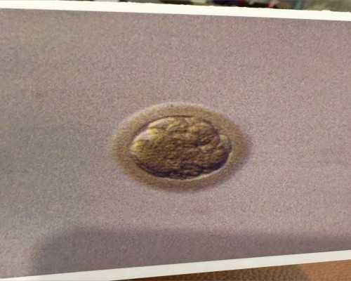 香港验血邮寄途径_香港验血鉴定男女准吗?最新价格是多少?