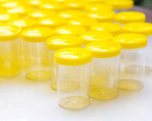 去香港验血找哪个中介比较好_怀孕香港验血晚上抽血可以吗_大陆可以验血查婴