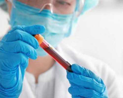 香港验血性别几周最准确_香港验血查询忘记验证码_几个y才是男的该如何预约